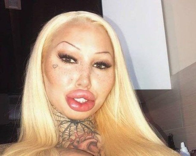 Crazy Huge Lips Fail: Girls Who Took Lip Injections A Little Too Far